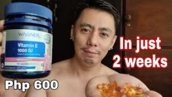 NURSE REVIEWS WAGNER NON SYNTHETIC VITAMIN E 1000 IU FOR ACNE, SCAR & HEALTH | REAL TALK REVIEW